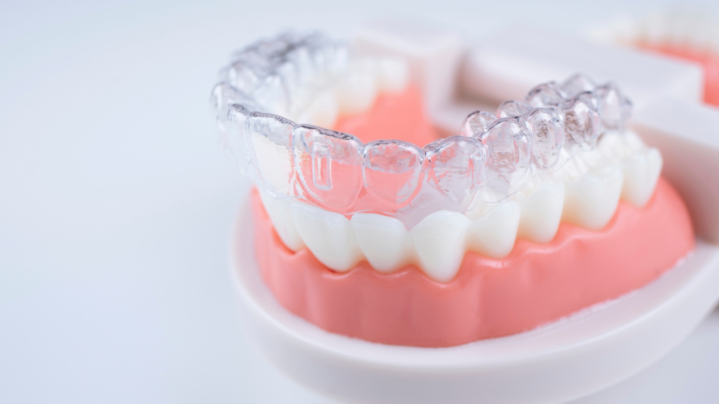 A clear dental aligner fitted over a model of teeth