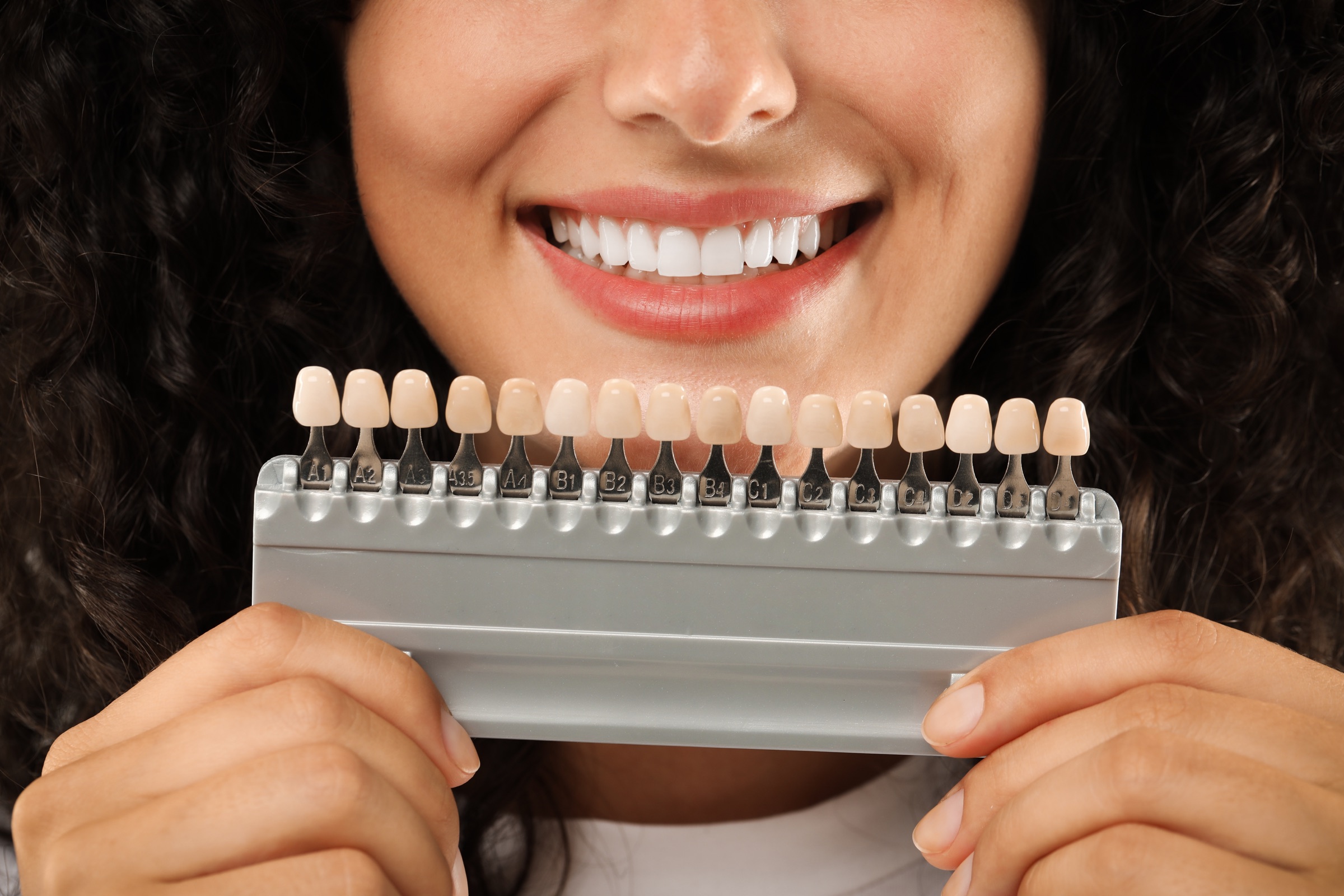 A patient comparing tooth shades for veneers